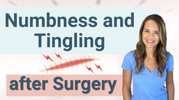 Numbness and Tingling After Surgery
