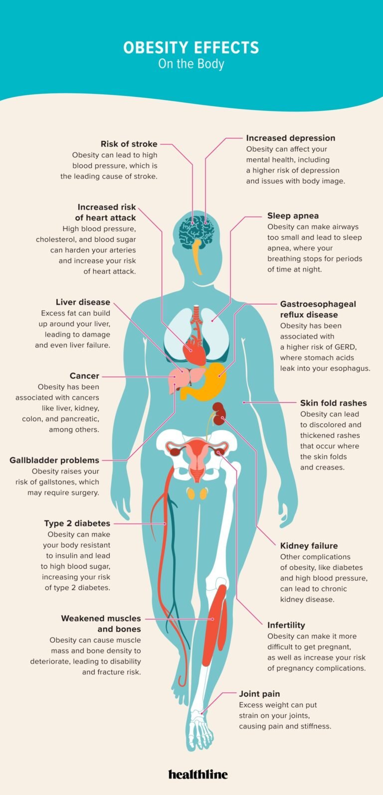 Obesity and Your Body