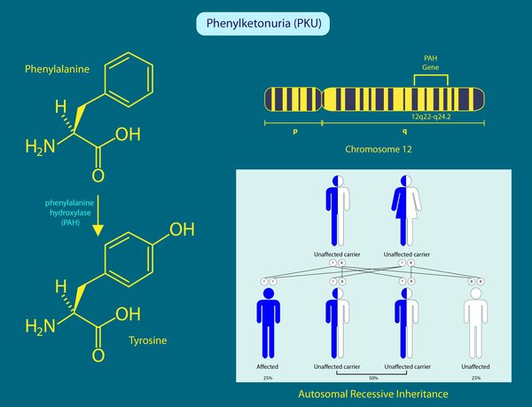 Phenylketonuria (PKU) Disease