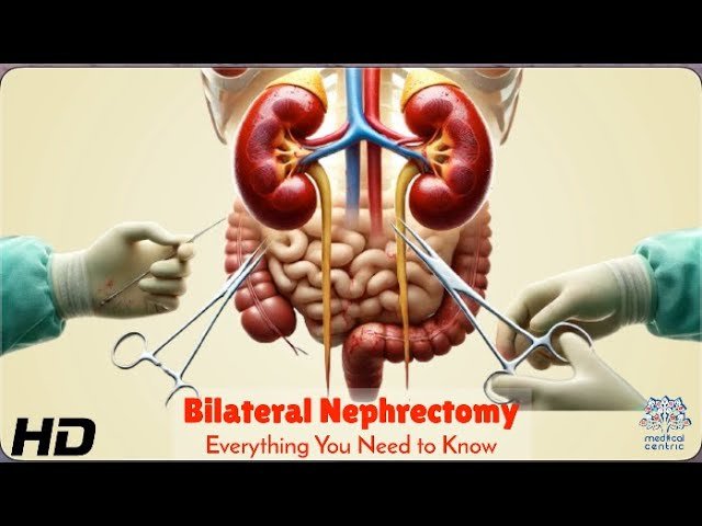 Nephrectomy_ Everything You Need to Know