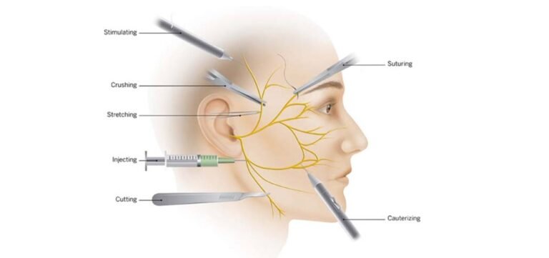 Nerve Damage After Plastic Surgery