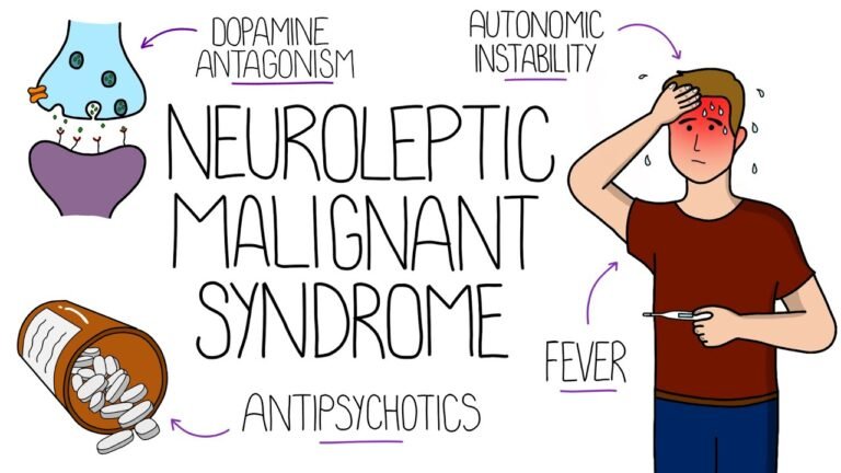 Neuroleptic Malignant Syndrome (NMS)