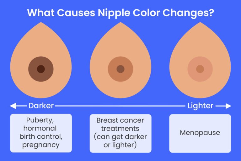 Nipple Color and Other Changes