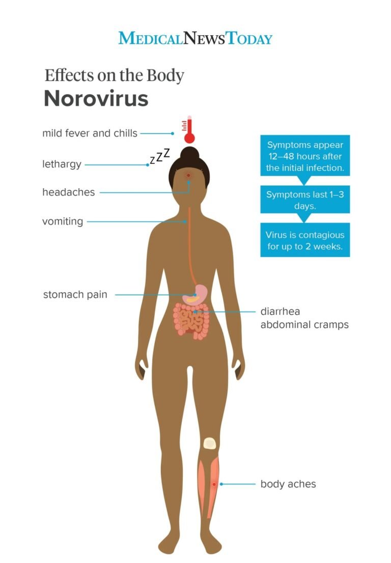 Norovirus Symptoms